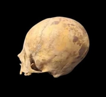 Experts solve mystery of ‘alien’ skull found in Argentina, revealing it belonged to a child buried 900 years ago with a reshaped head due to ancient cranial deformation rituals.