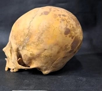 Experts solve mystery of ‘alien’ skull found in Argentina, revealing it belonged to a child buried 900 years ago with a reshaped head due to ancient cranial deformation rituals.