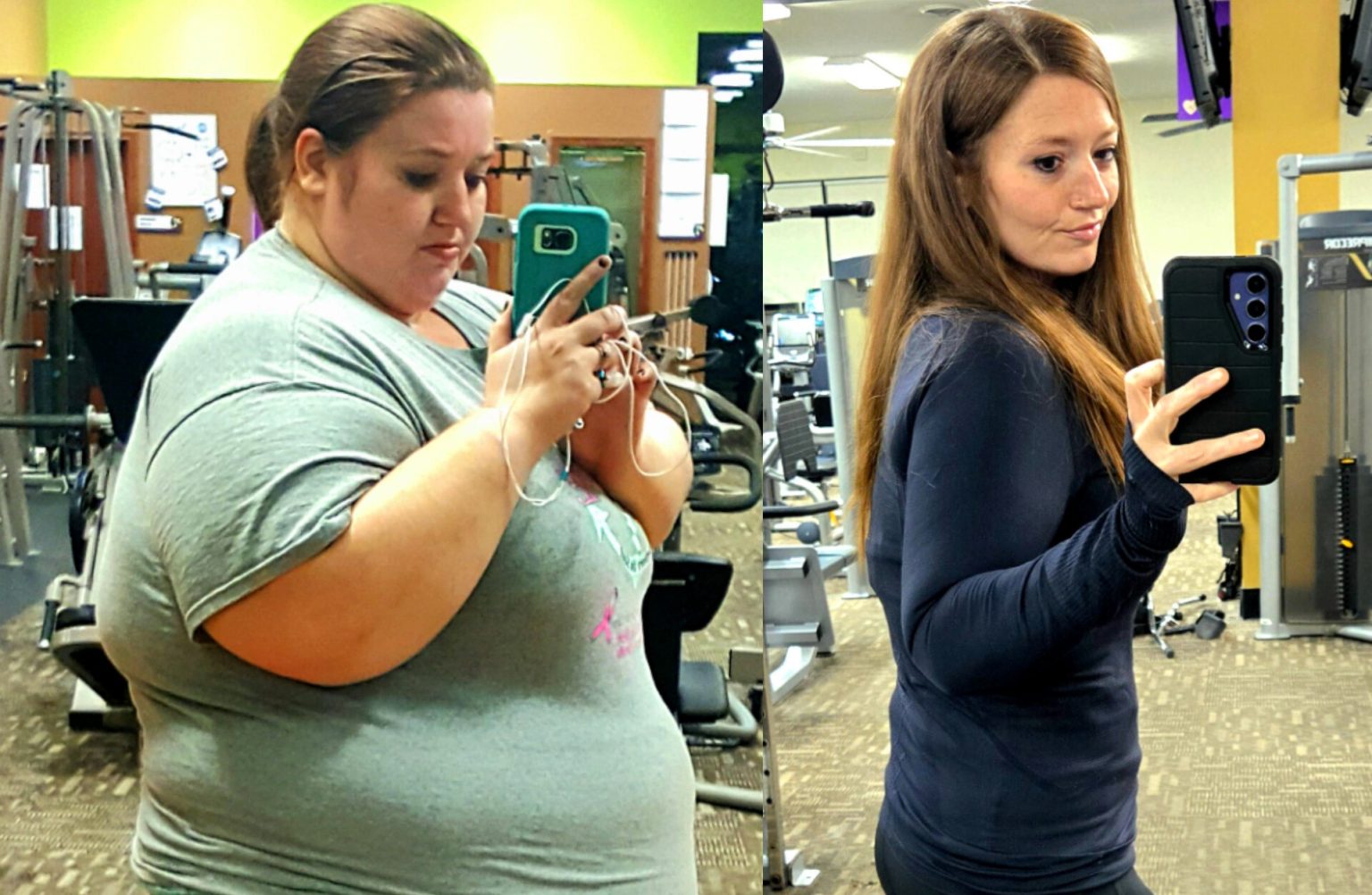 Lexi Reed lost 312lbs and now embraces her body with scars and loose skin from her battle with calciphylaxis - proud in swimsuits but unable to swim due to open wounds.