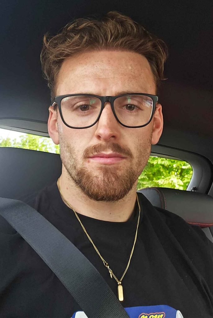 Bradley, once mocked for his hair loss, transformed his confidence with a 3,000 graft hair transplant in Turkey after years of struggles and a painful dating rejection.