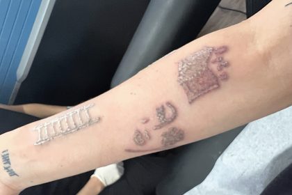 Singer Kayla Stewart spends £5,200 to remove 33 tattoos linked to a traumatic past, describing the laser process as five times more painful than getting inked.