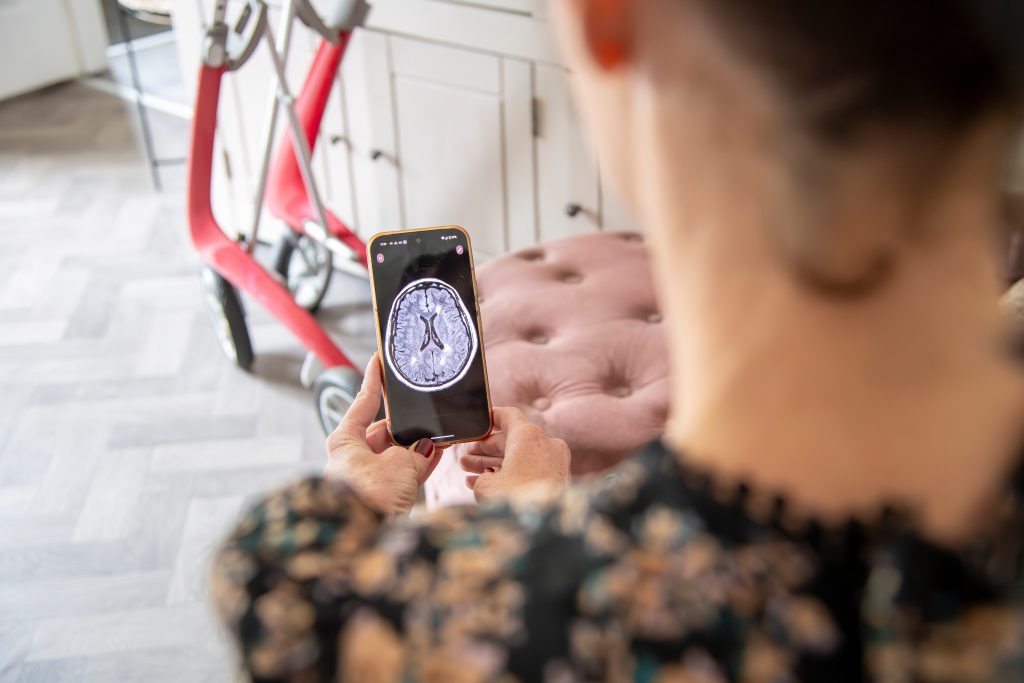 Leanne Jones lost her sex drive due to a brain condition linked to MS, straining her relationship. Now she raises awareness about how neurological disorders impact intimacy.