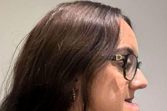 Shy woman with a severe underbite reveals life changing transformation after painful jaw surgery - eight years of braces and months of recovery left her unrecognisable.