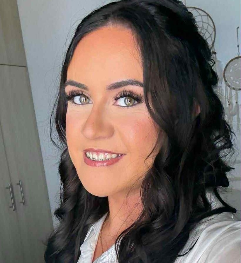 Shy woman with a severe underbite reveals life changing transformation after painful jaw surgery - eight years of braces and months of recovery left her unrecognisable.