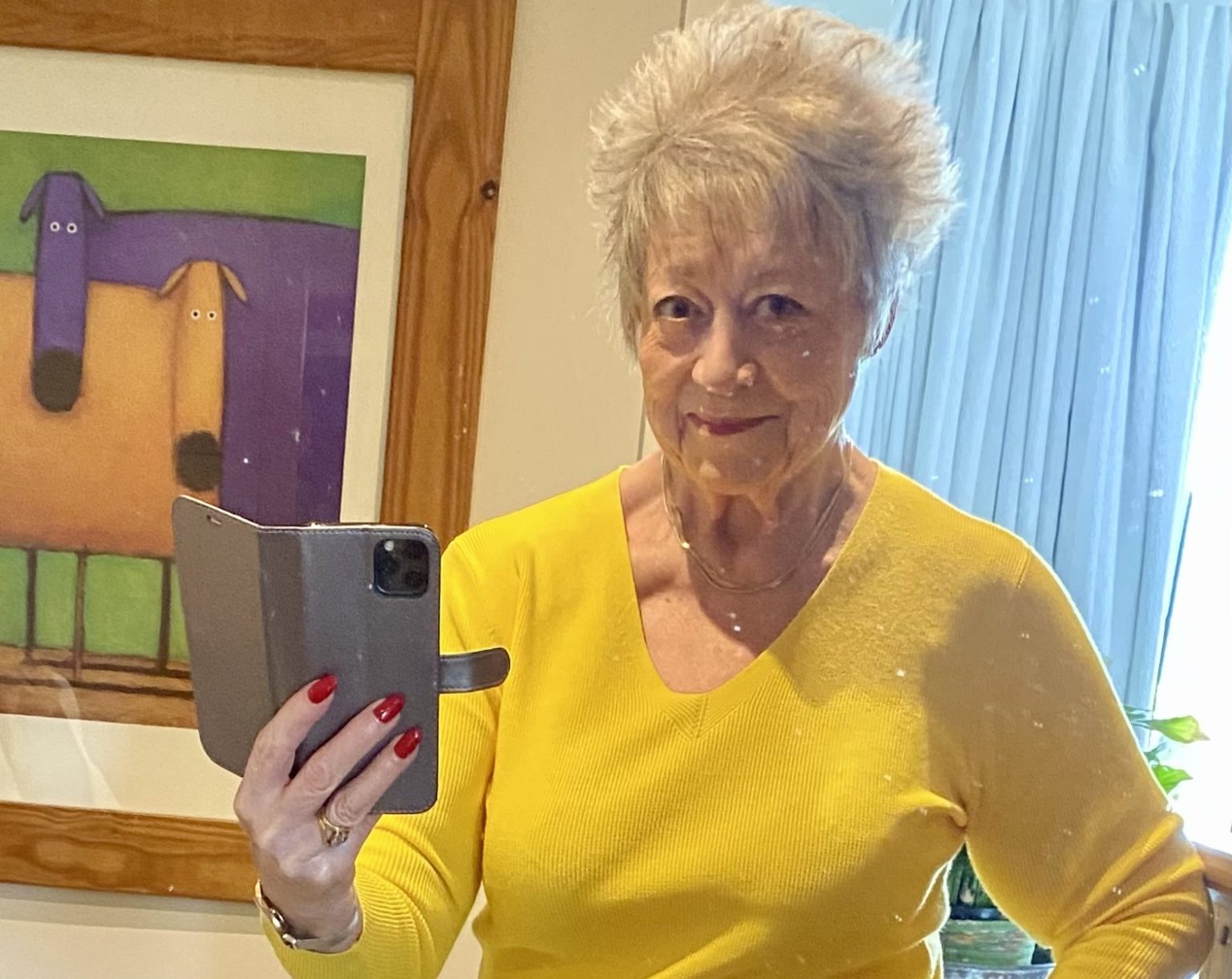 75-year-old Susan Forgie lost 12st with Mounjaro, reversed health issues, cut meds, and dropped her metabolic age by 16 years - proving it’s never too late to transform.