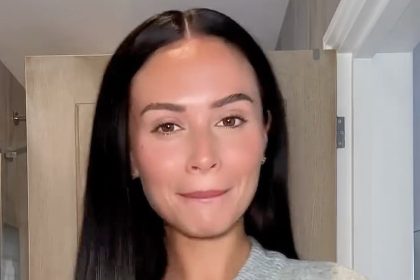 Love Island star Olivia Hawkins has dissolved her lip filler and unveiled her natural pout - telling fans she doesn’t recognise herself but loves her new look.