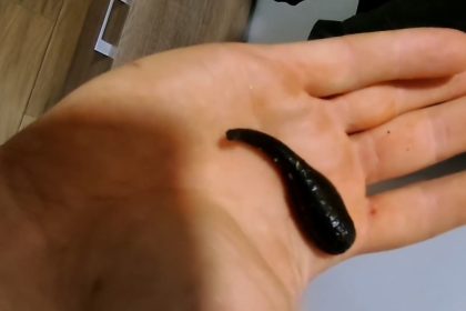 Celebrity forester Dawid Kontny finds giant leech in his boot after fishing trip in Poland - shocked after blood-soaked sock revealed creature feeding on his Achilles.