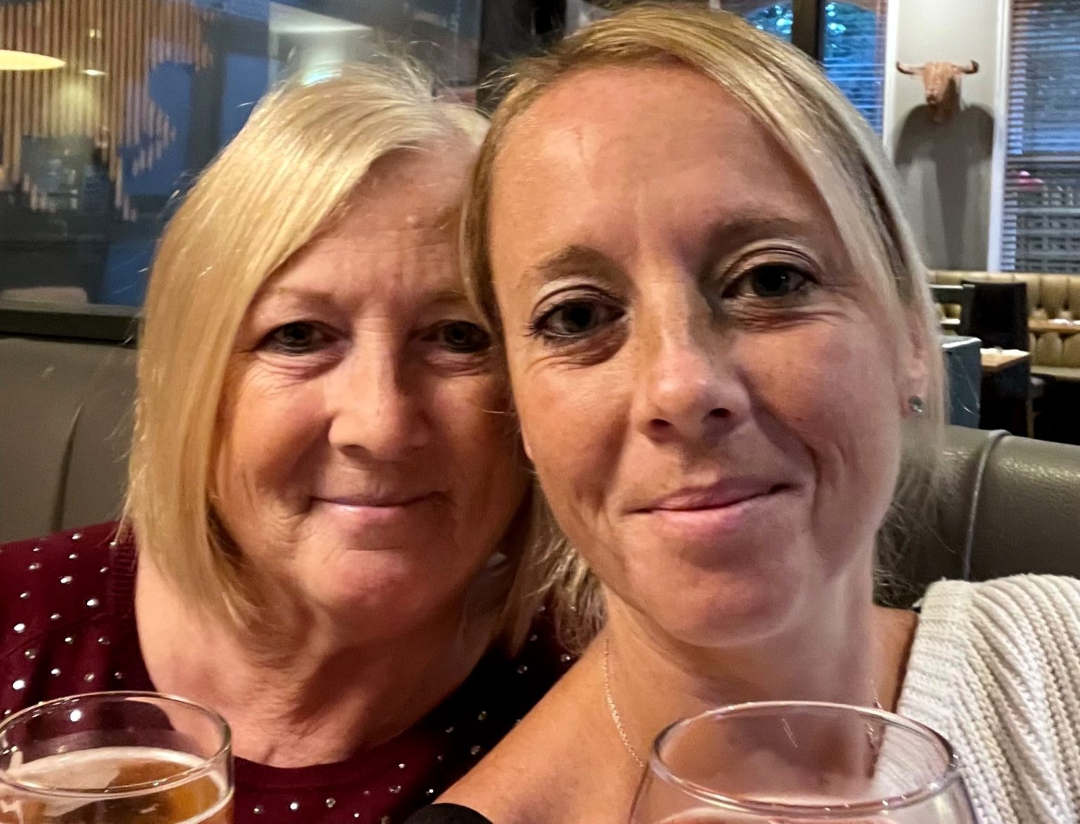 Gran Shirley Bartram, 69, lost fingers and toes after a sepsis misdiagnosis and antibiotic blunder left her in a coma - now she seeks answers and warns of sepsis dangers.