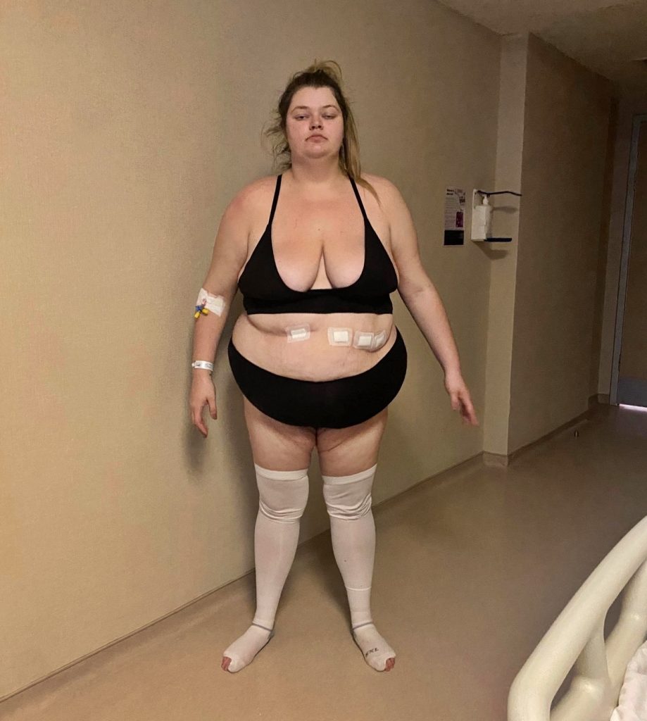 Ellie Jefferies stuns TikTok with 12st weight loss glow up, leaving fans comparing her to Margot Robbie. The 26-year-old transformed after gastric sleeve surgery in Turkey.