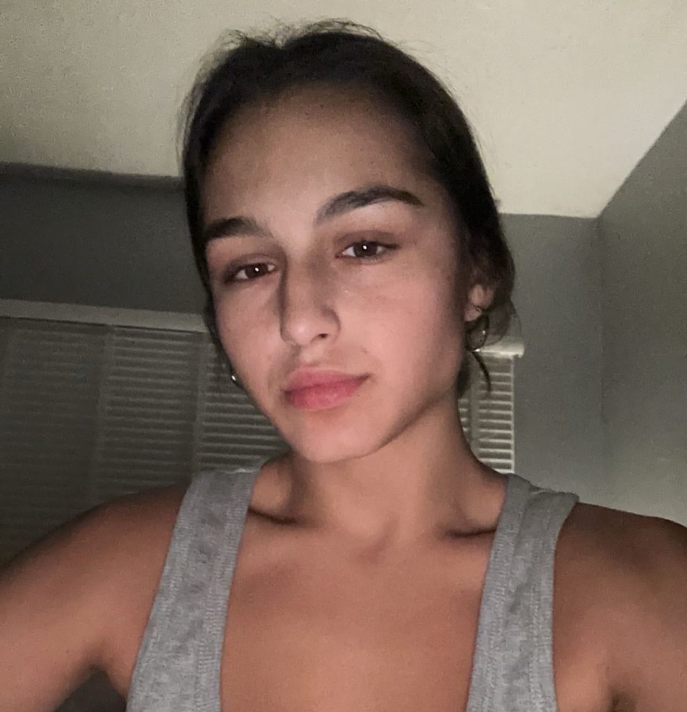 Doctors dismissed 23-year-old Leah Kalkan’s pain as “meat sweats” before scans abroad revealed a grapefruit-sized spinal tumour. She beat rare cancer after months of treatment.