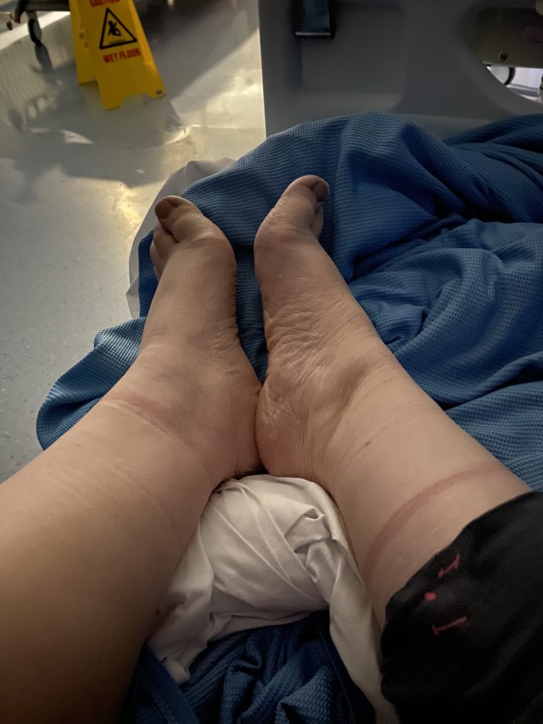 Beverley Cuddy says Mounjaro weight loss jabs saved her life after years of food addiction. Despite rising costs, she vows to keep paying as the results are priceless.