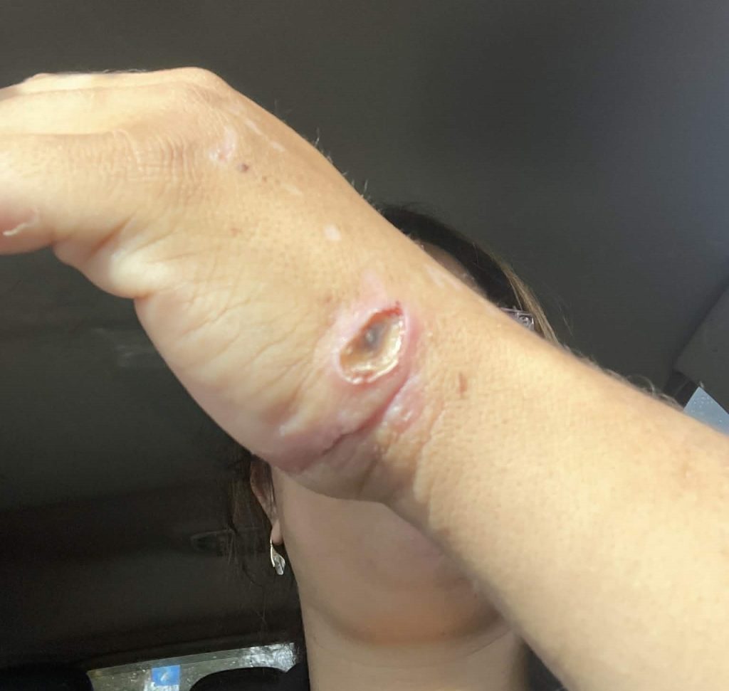 A brave mum fought off a pit bull with a plant pot after it mauled her four-year-old daughter leaving the child with severe facial injuries and lasting trauma.