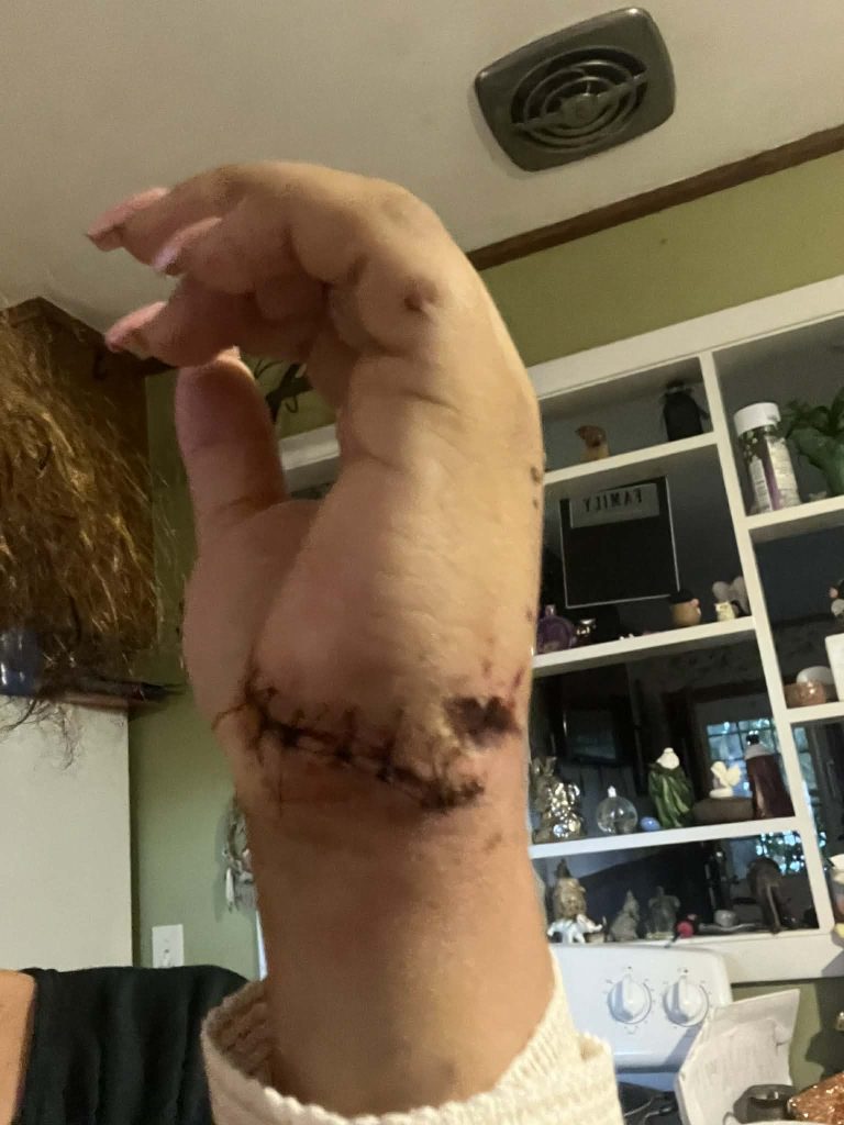 A brave mum fought off a pit bull with a plant pot after it mauled her four-year-old daughter leaving the child with severe facial injuries and lasting trauma.