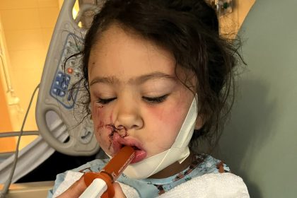 A brave mum fought off a pit bull with a plant pot after it mauled her four-year-old daughter leaving the child with severe facial injuries and lasting trauma.