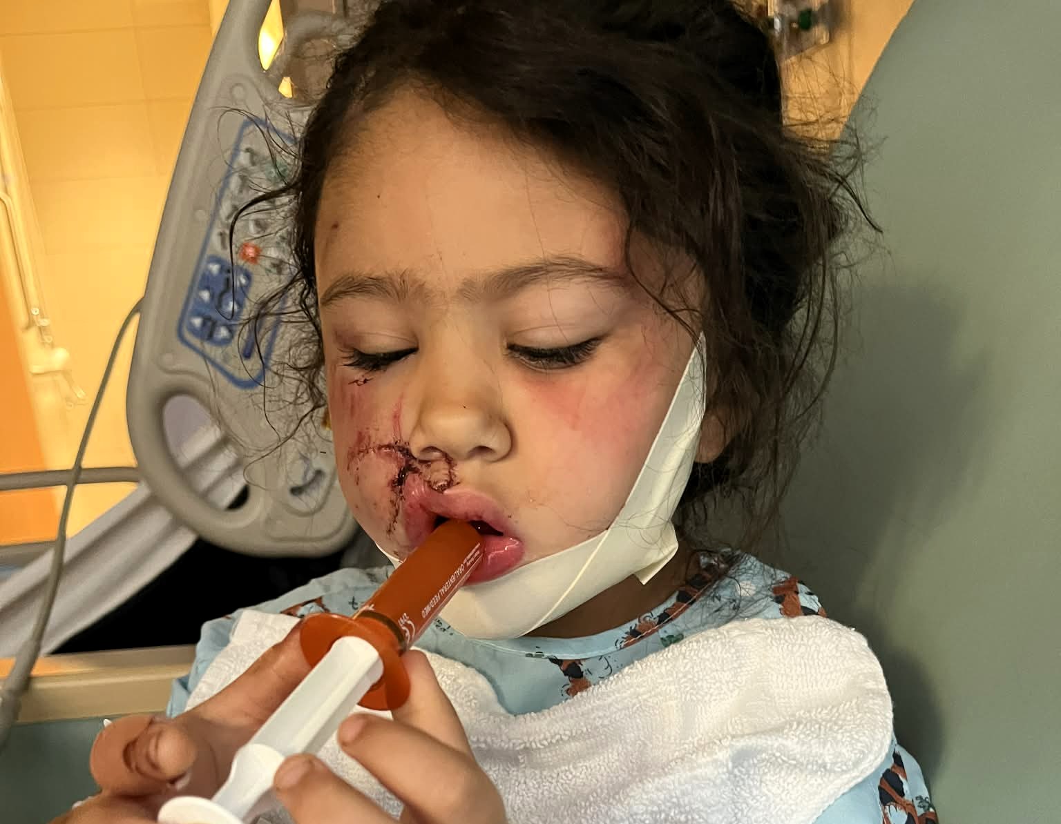 A brave mum fought off a pit bull with a plant pot after it mauled her four-year-old daughter leaving the child with severe facial injuries and lasting trauma.
