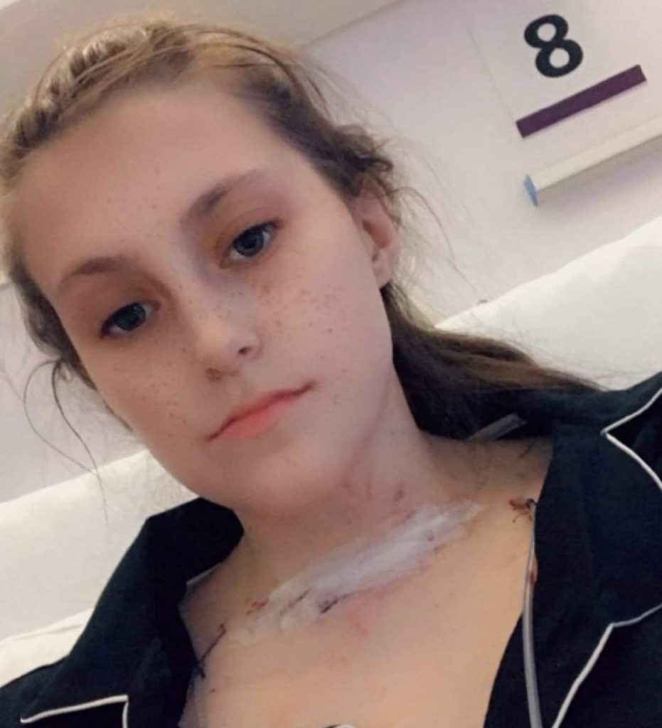 Becky Bowes discovered a hidden neck lump was thyroid cancer that spread to her lungs - now she urges others to check their necks regularly before it’s too late.