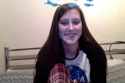 Becky Bowes discovered a hidden neck lump was thyroid cancer that spread to her lungs - now she urges others to check their necks regularly before it’s too late.