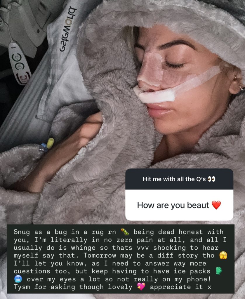 Love Island star Lolly Hart has revealed she’s recovering in hospital after a piezo ultrasonic nose job, saying she’s in “zero pain” and excited to see her new look.