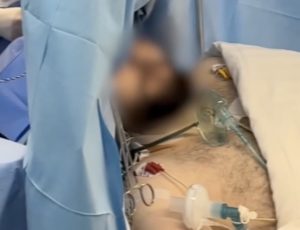 Opera singer Ştefan Muţ sang Mozart’s The Marriage of Figaro while surgeons removed his brain tumour in Romania - the risky awake surgery ended successfully with no damage.