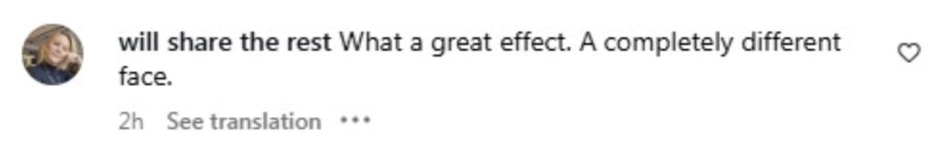 Social media comment on the post of Reality star Laluna Unique revealed her mum’s stunning new smile after gifting her a full set of Turkey teeth in Istanbul, with fans praising the transformation as spectacular.