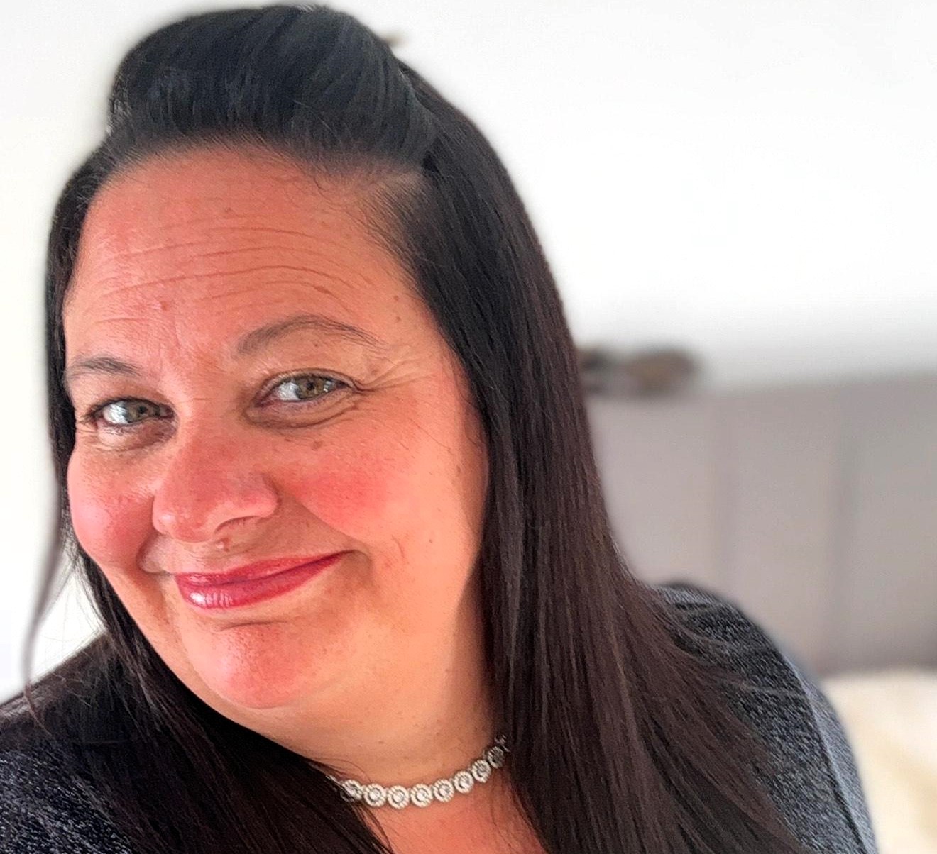 A woman awarded £17000 after a botched dental bridge left her in agony says four healthy teeth were drilled unnecessarily leaving her disfigured and terrified of dentists.