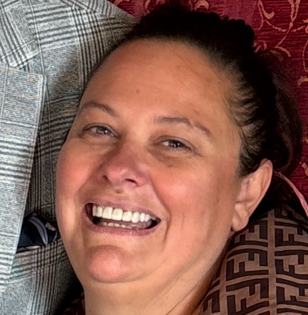 A woman awarded £17000 after a botched dental bridge left her in agony says four healthy teeth were drilled unnecessarily leaving her disfigured and terrified of dentists.