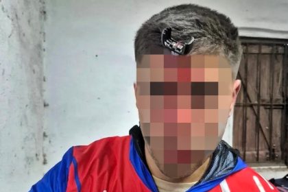 Football dad stabbed in the forehead with a car key during a chaotic U16 match brawl in Argentina as police arrest a suspect and surgeons remove the lodged key after a violent pitch side fight.