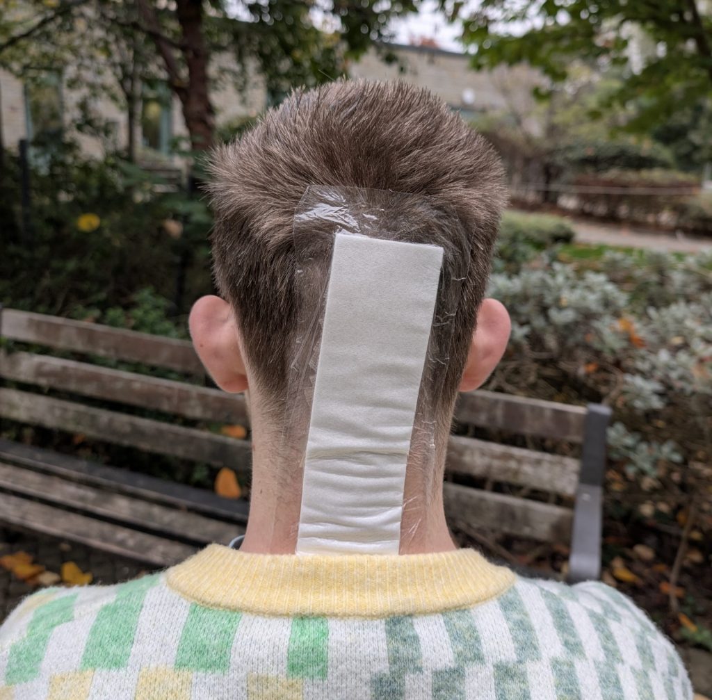 Mum saves son’s life after doctors dismiss brain tumour symptoms as exam stress. Optician visit leads to shock diagnosis and life-saving surgery for 16-year-old Jamie.