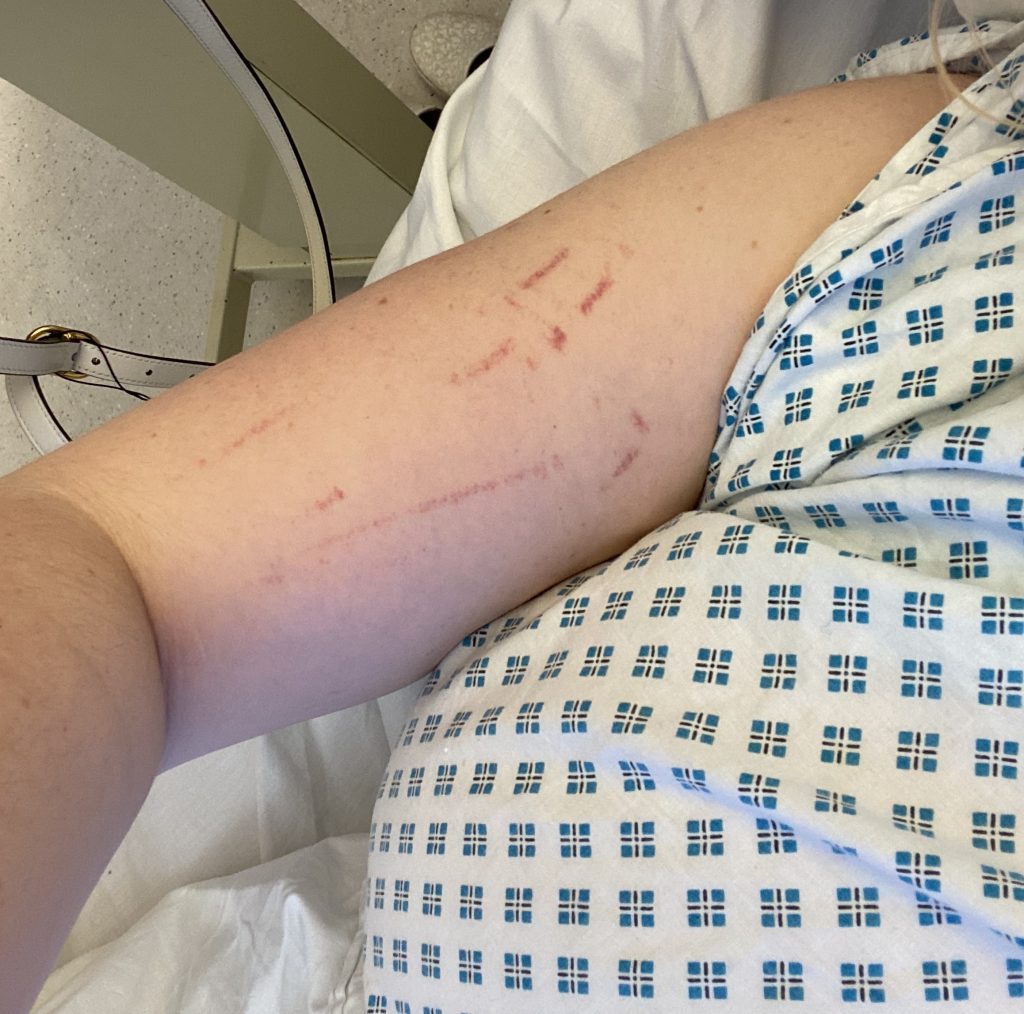 Woman struck by rare ‘thunderclap’ headache syndrome rebuilds life after losing her high-flying career. Victoria Harman launches her own fashion brand while managing recovery.