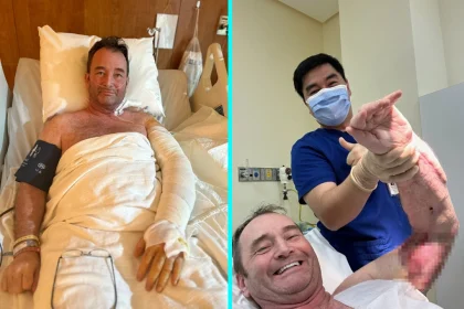 Fitness fanatic lost muscle in 25 operations after a sore throat and gym workout triggered necrotising fasciitis, the flesh-eating disease that nearly killed him and cost £450,000 to treat.