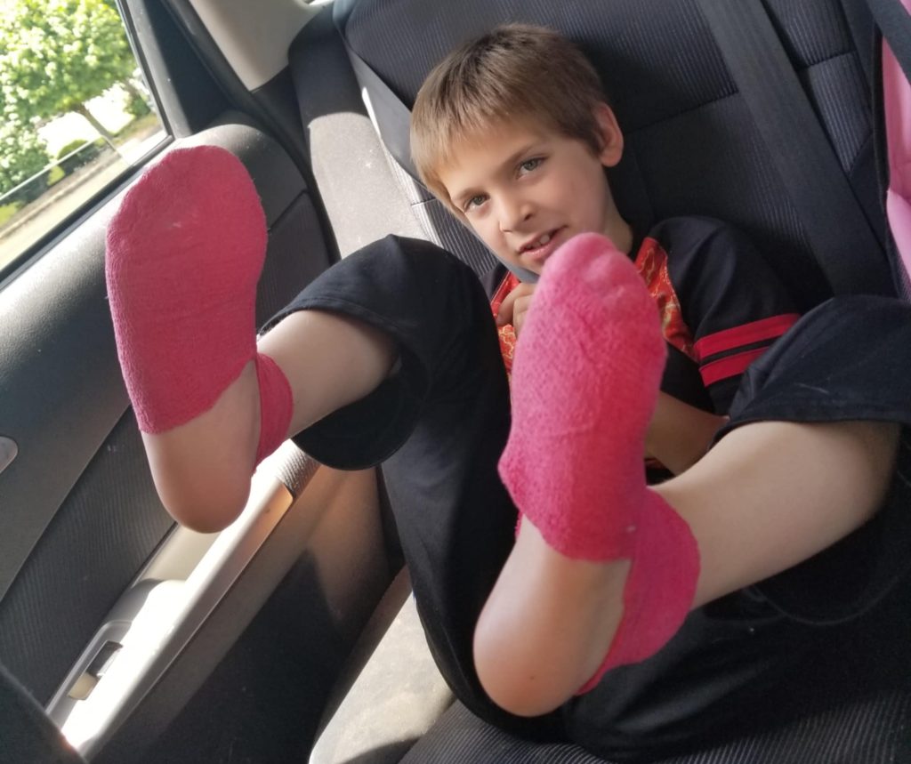 Mum warns parents before Christmas after light up shoes leaked battery acid on her sons feet, causing second degree burns and lasting nerve damage after getting wet at school.