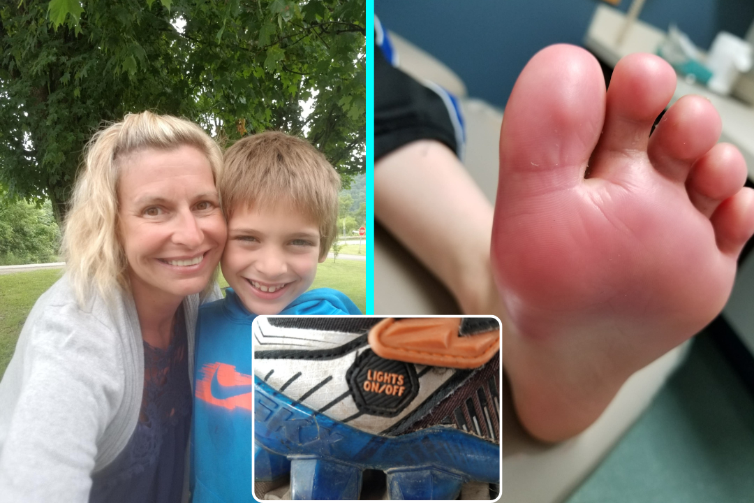 Mum warns parents before Christmas after light up shoes leaked battery acid on her sons feet, causing second degree burns and lasting nerve damage after getting wet at school.