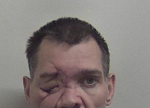 A burglar who discharged himself from hospital after a life-threatening crash continued his crime spree, committing six burglaries and stealing over £3,000 worth of items including war medals before arrest.