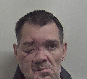 A burglar who discharged himself from hospital after a life-threatening crash continued his crime spree, committing six burglaries and stealing over £3,000 worth of items including war medals before arrest.