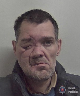 A burglar who discharged himself from hospital after a life-threatening crash continued his crime spree, committing six burglaries and stealing over £3,000 worth of items including war medals before arrest.