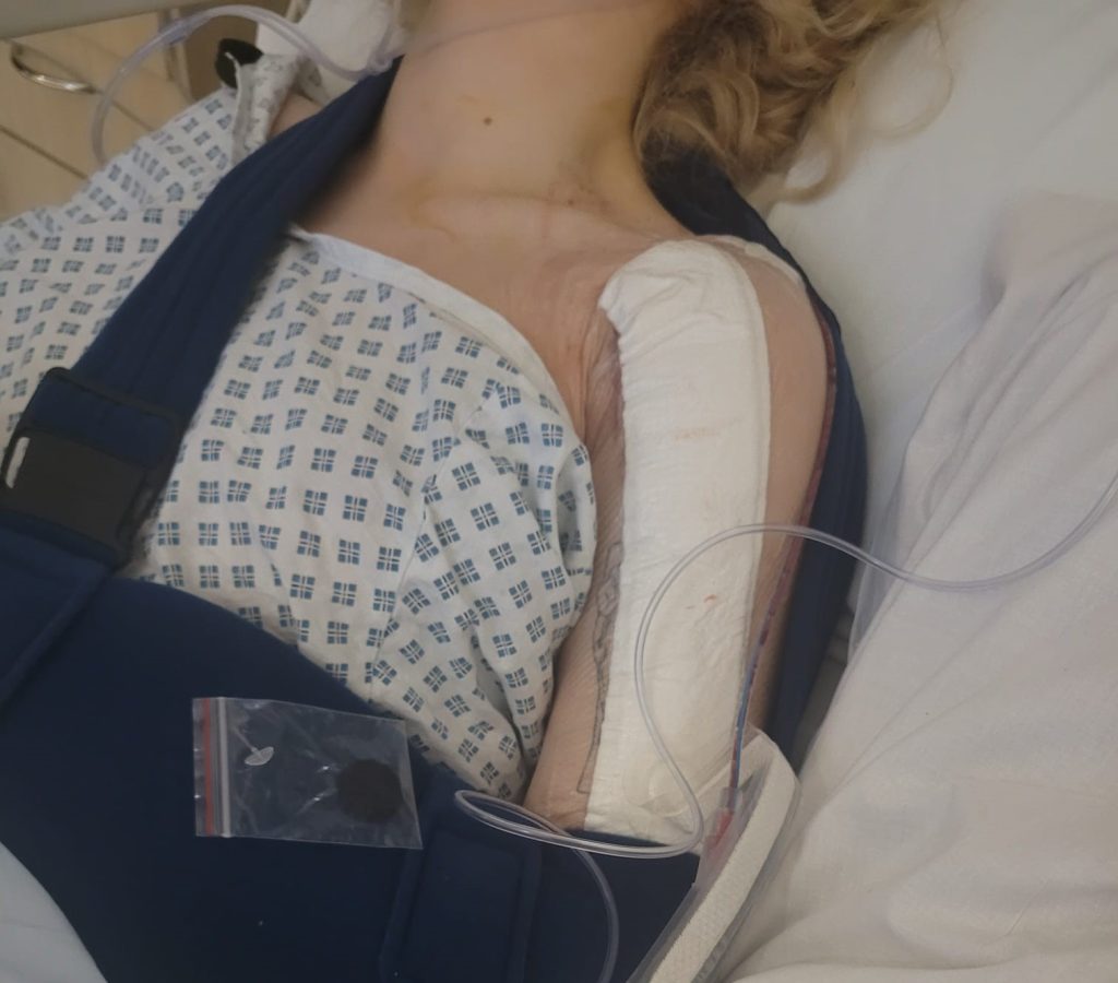 Young woman learns she has rare bone cancer after reading tumour results on NHS app- a shocking diagnosis that changed her life and fuels calls for patient communication.