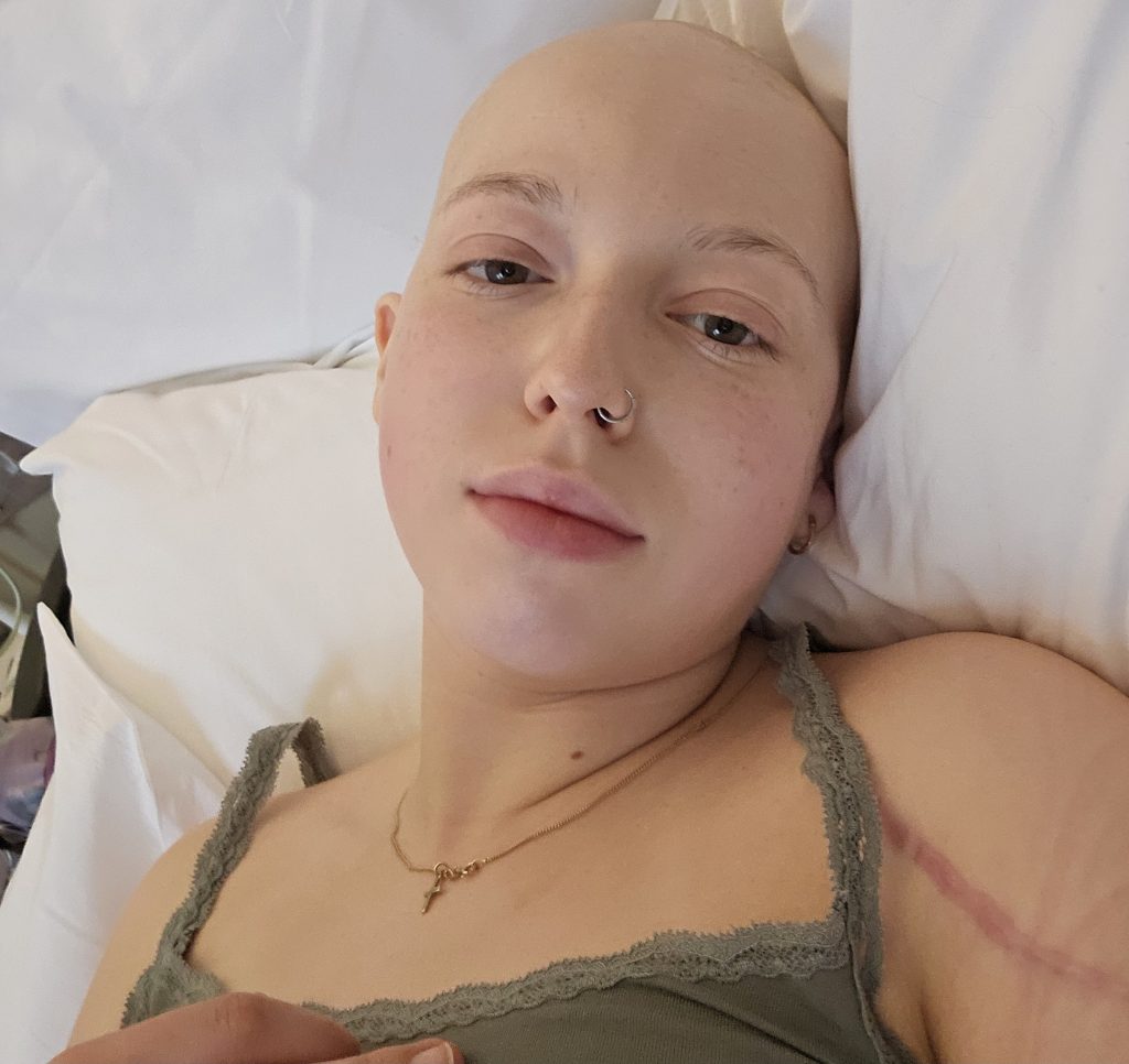 Young woman learns she has rare bone cancer after reading tumour results on NHS app- a shocking diagnosis that changed her life and fuels calls for patient communication.