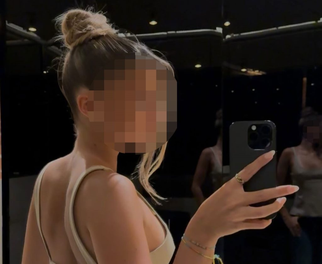 Former footballer Mehmet Scholl's daughter Josefine, 17, reveals she has McCune-Albright syndrome, a rare genetic disorder affecting bones. The fashion model shares her daily pain.