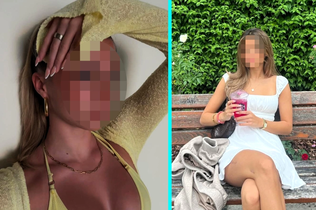 Former footballer Mehmet Scholl's daughter Josefine, 17, reveals she has McCune-Albright syndrome, a rare genetic disorder affecting bones. The fashion model shares her daily pain.