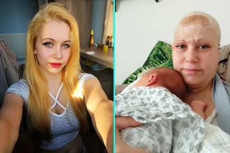 Mother's scalp and hair torn off in horror factory accident reveals heartbreaking truth - her own children sometimes fail to recognise her when she changes wigs.