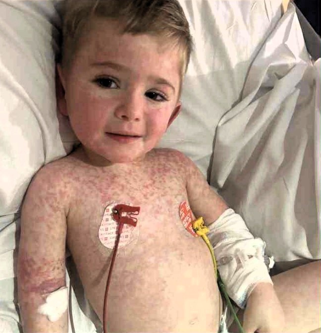 Three-year-old Elijah John needs a lifesaving bone marrow transplant after being diagnosed with primary HLH - a rare genetic disorder where every infection could be fatal.