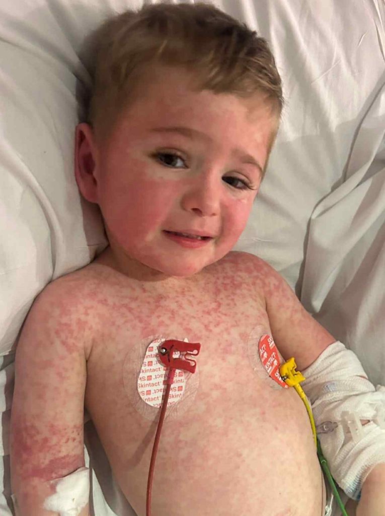 Three-year-old Elijah John needs a lifesaving bone marrow transplant after being diagnosed with primary HLH - a rare genetic disorder where every infection could be fatal.