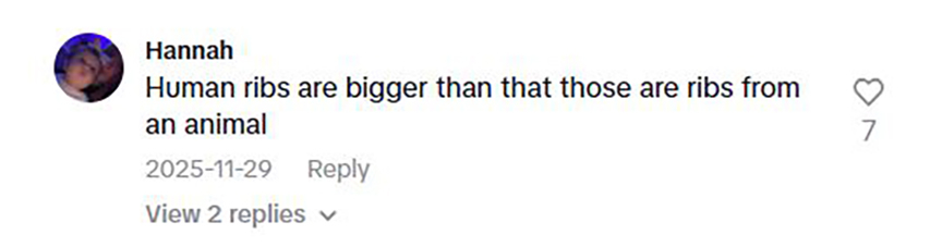 Social media comment on the post of Influencer makes bone broth from ribs removed for wasp waist surgery. Adea Danielle froze them 6 months before cooking. Shocking video goes viral with 16.8m views.