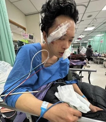 Stuntman Su Deyang hospitalised with brain bleed and facial fractures after high-fall stunt goes wrong in Taiwan. Only half his body landed on mattresses, face-planted on concrete.