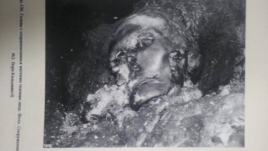 Woman who died 2,500 years ago survived complex jaw surgery after a severe head injury - CT scans reveal the earliest known example of such an operation in ancient Siberia.