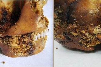 Woman who died 2,500 years ago survived complex jaw surgery after a severe head injury - CT scans reveal the earliest known example of such an operation in ancient Siberia.