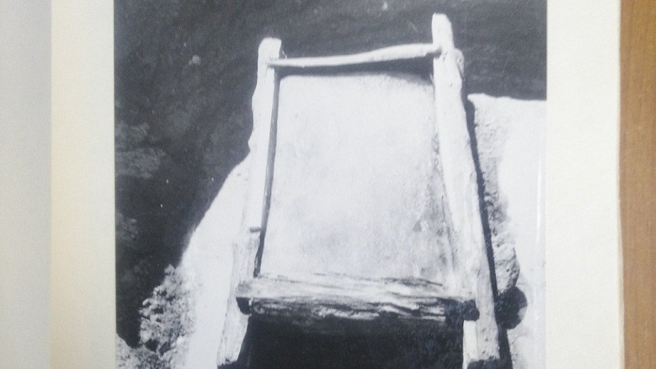 Woman who died 2,500 years ago survived complex jaw surgery after a severe head injury - CT scans reveal the earliest known example of such an operation in ancient Siberia.