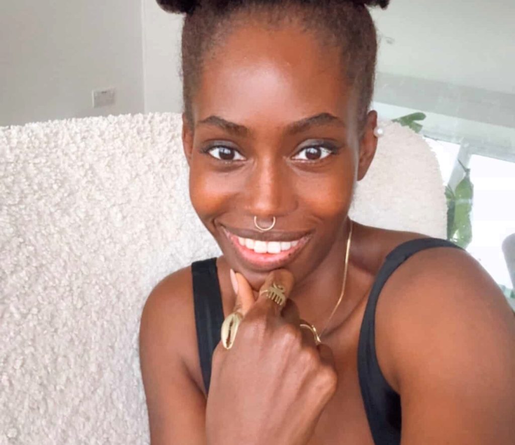 A London woman felt like a "prisoner in her own body" after a rare condition left her skin constantly peeling, oozing and shedding - until diet changes and holistic healing transformed her life.