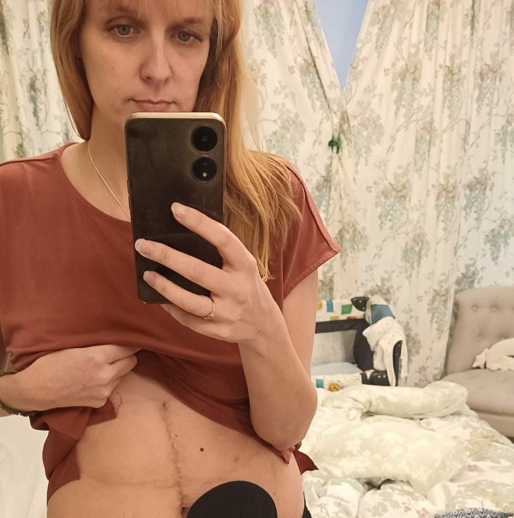 Mum Caroline Padmore spent seven years visiting A&E with severe pain before doctors finally found multiple tumours - her advanced ovarian cancer was missed time after time.