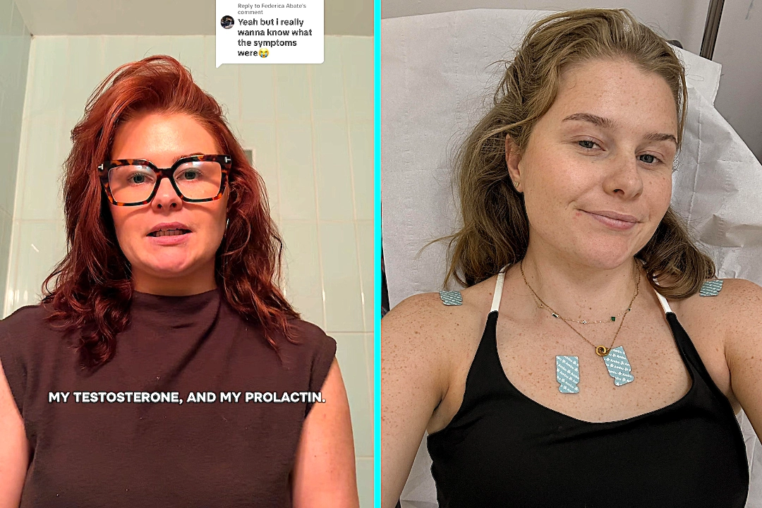 Woman takes at-home fertility blood test due to irregular periods and discovers she has a brain tumour. The 27-year-old found out over the phone at a work party.